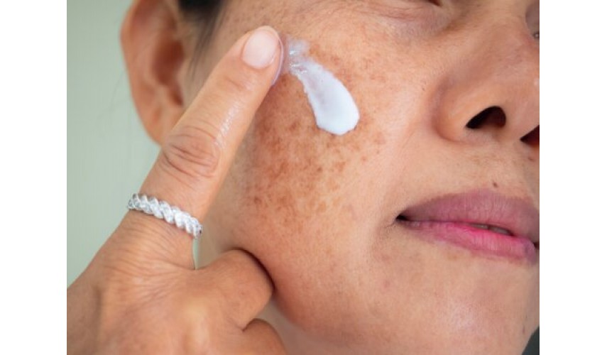 Spots on the skin of the face
